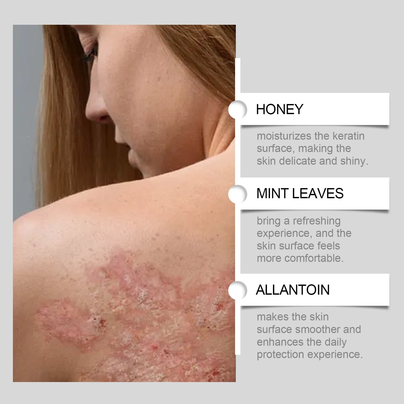 Gentle Eczema Repair Cream