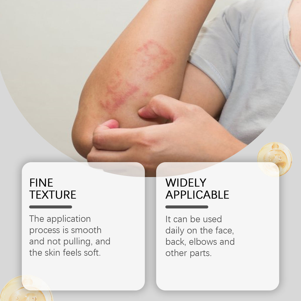 Gentle Eczema Repair Cream